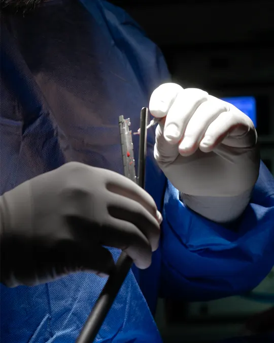 Surgical stapler prepared for a laparoscopic gastric sleeve in Tijuana